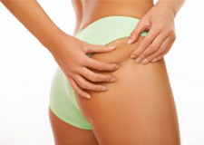 Liposukcija