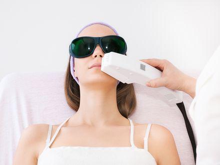 Depilacija dlačic na obrazu