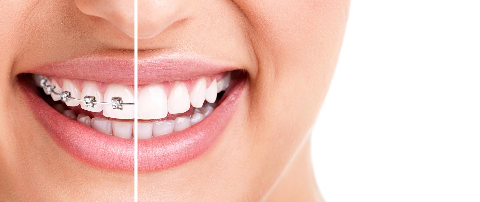 Ortodont ljubljana cenik