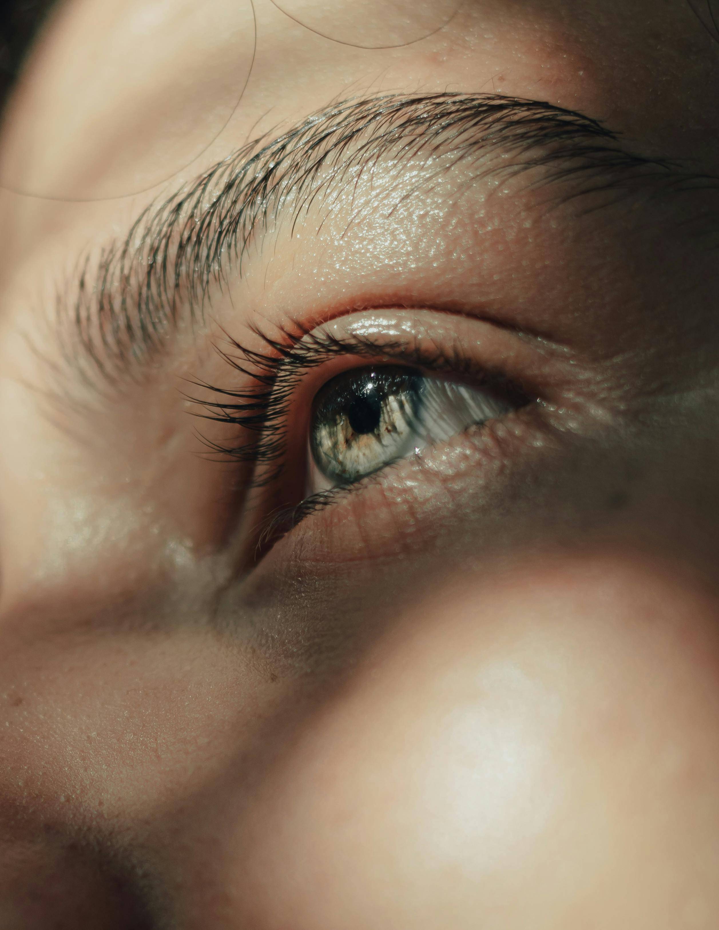 blefaroplastika z laserjem